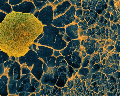 Human Stem Cell Embedded In A D Matrix Cryo Sem Wellcome Collection