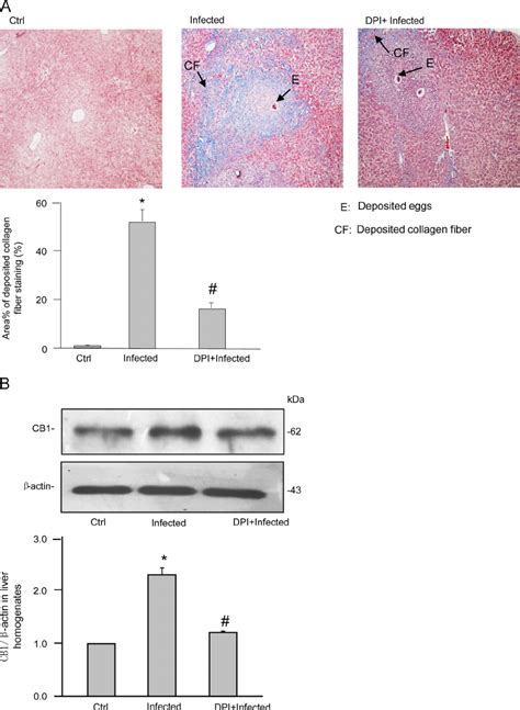 Pathological Changes And Cb Expression In Livers From Mice Infected