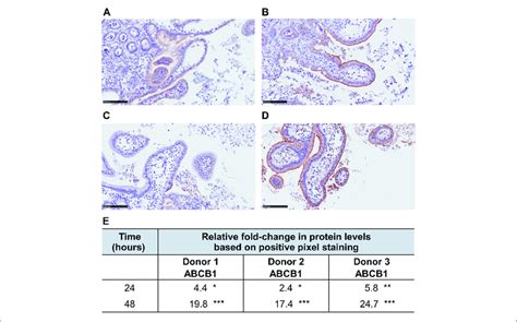 Abcb1 Levels Indicated By Brown Staining In Rif Free Samples Download Scientific Diagram