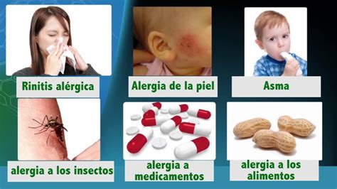 Medicina Para Todos Alergias Youtube