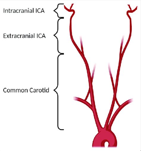 The Common Carotid Stretches From The Aortic Arch To The Bifurcation Of