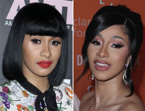 Cardi B Nose Job A New Look Alongside Musical Journey