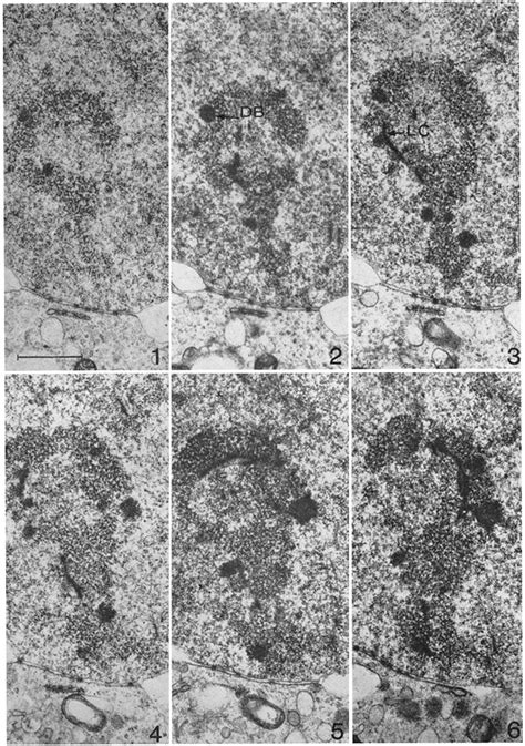 Electron Micrographs Of Serial Consecutive Sections Through The Sex