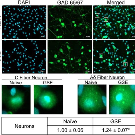 GSE Increased GAD 65 67 Immunostaining Levels In Trigeminal Neurons