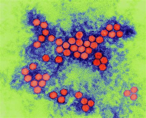 Polio Virus By Dennis Kunkel Microscopy Science Photo Library