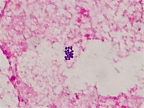 Peptostreptococcus micros〔口腔内嫌気性菌〕 | グラム染色: Gram Stain