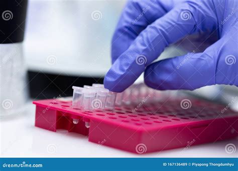 Polymerase Chain Reaction PCR and Agarose Gel Electrophoresis is a ...