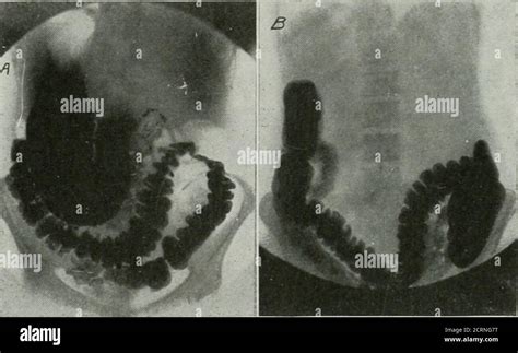 The American Journal Of Roentgenology Radium Therapy And Nuclear