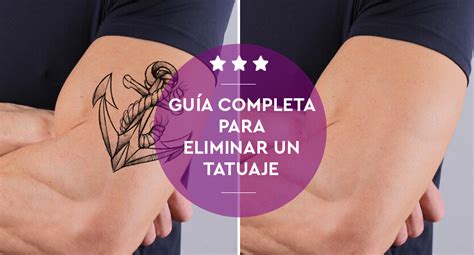 Descubrir Imagem Cuanto Cuesta Eliminar Un Tatuaje Con Laser