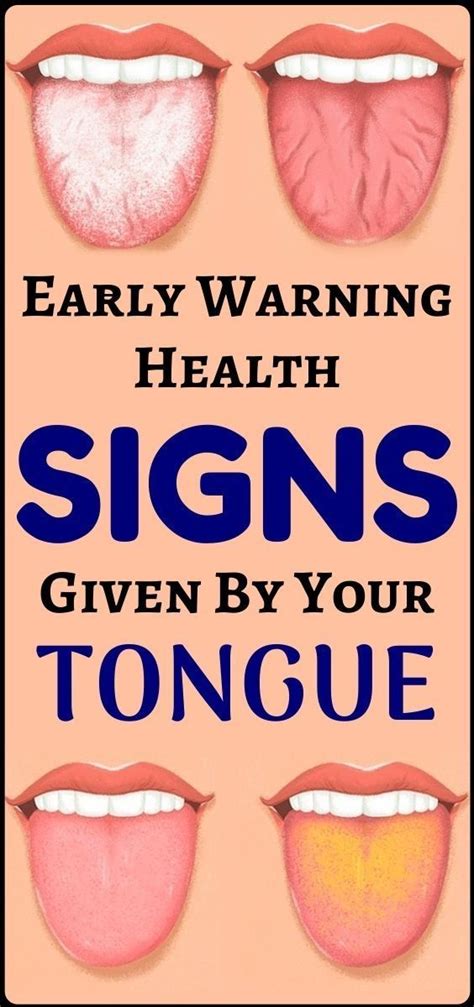 What Does Your Tongue Say About Your Health Quoqlee