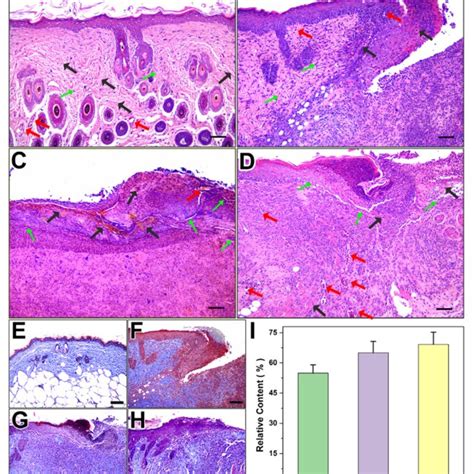 Histological Analysis Of Wounds On The Dorsum Of Mice By H E Staining