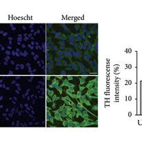 Differentiation of SH-SY5Y cells. (a) SH-SY5Y cells were treated with ...