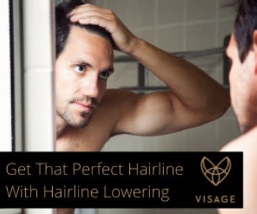 Perfect Hairline Technique