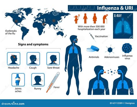 Influenza & Upper Respiratory Tract Infections Stock Vector - Image ...