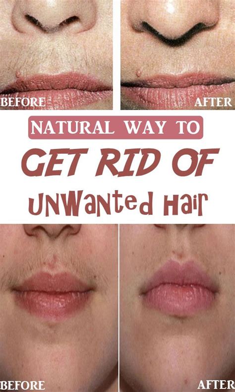 Natural Way To Get Rid Of Unwanted Hair At Home Pin Advice Get Rid