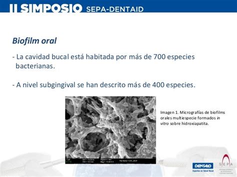 Los Biofilms Bucales Ii Simposio Sepa Dentaid