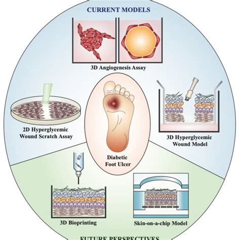 A Review Of Diabetic Wound Modelsnovel Insights Into Diabetic Foot