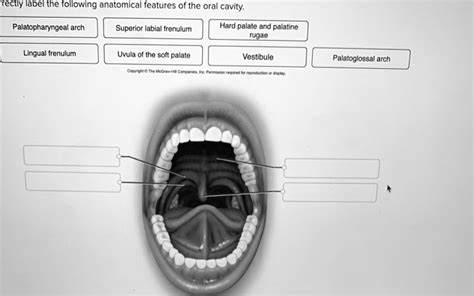 Please Correctly Label The Following Anatomical Features Of The Oral