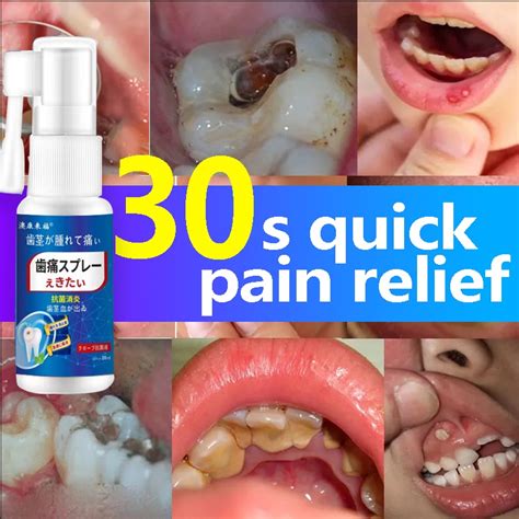 Toothache Oral Spray Toothache Reliever Teeth Care Pain Relief Gum Inflammation And Swelling