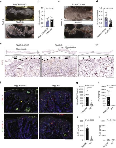 Divergent Roles of Epithelium-Derived Alarmins in Notch Signaling-Deficient Skin - Journal of ...