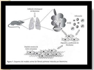 Toxicidad Pulmonar Por Quimio Terapia Ppt Descarga Gratuita