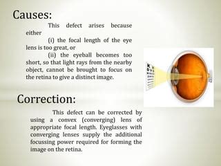 defects  eye class  phy pptx