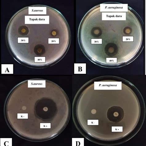 Gambar 3 Hasil Uji Aktifitas Antibakteri Ekstrak Etanol Daun Tapak