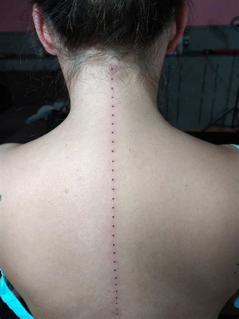 Chiari Malformation Tattoos