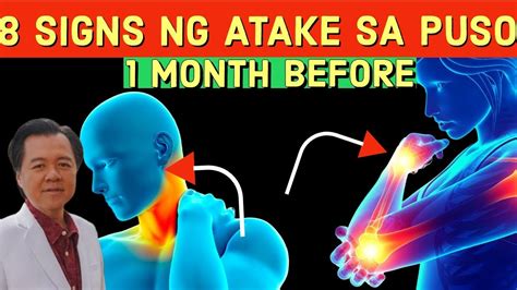 8 Warning Signs Ng Atake Sa Puso Bago Ito Mangyari By Doc Willie Ong Youtube