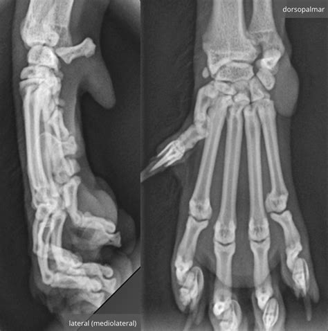 Carpus Metacarpus And Phalanges Diagram Quizlet