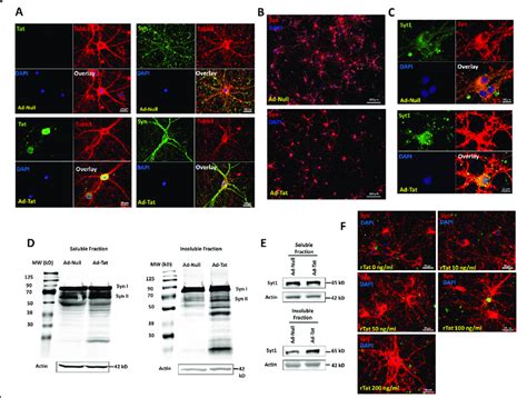 Hiv Tat Promotes Alterations In Synaptic Vesicle Proteins