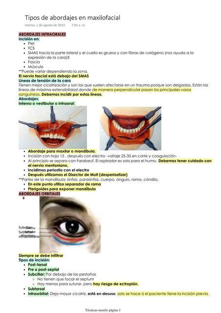 Tipos De Abordajes En Cirugía Maxilofacial Laura Parra Udocz