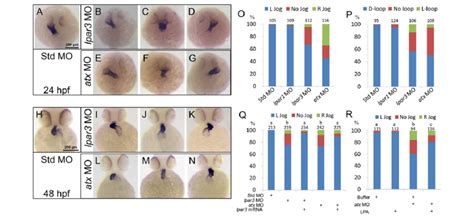 The Atx Lpar Axis Mediates Cardiac Laterality A P Zebrafish Embryos