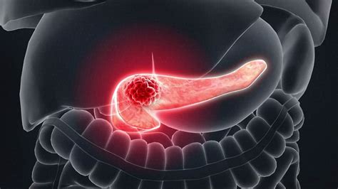 Incretin Mimetics Market: Novel Drug Formulations and Delivery Systems ...