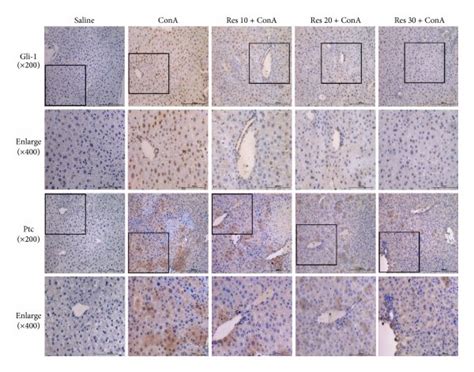 Immunohistochemistry Used To Detect The Expression Level Of Gli 1 And