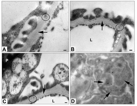 Immunogold Labeling Of Kidney Cortical Tissue Of 11 Month WT And Hgsnat