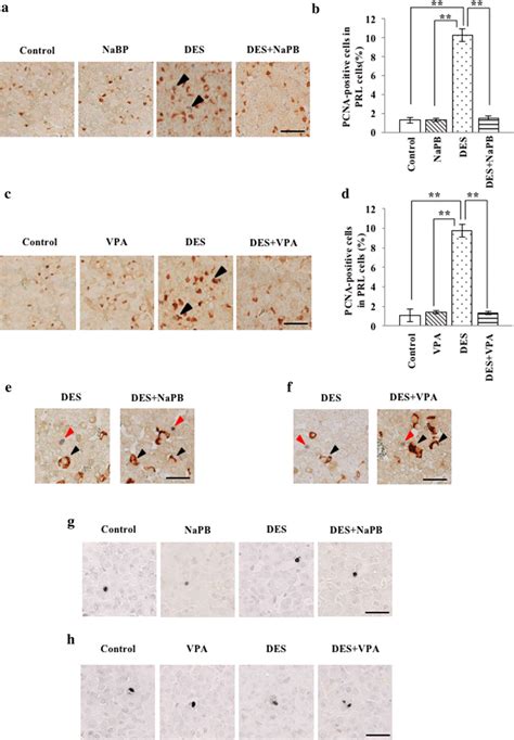 Effects Of Vpa On Cell Proliferation And Apoptosis In Pituitaries Of