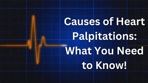 Causes Of Heart Palpitations What You Need To Know Youtube