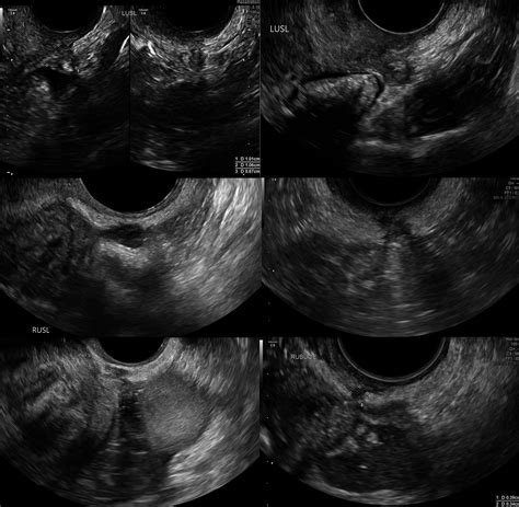 A Pictorial Guide To The Ultrasound Identification And Assessment Of