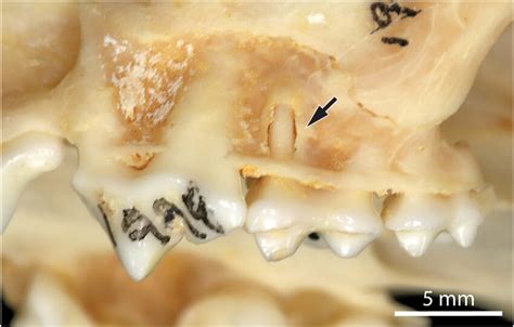 Fenestration Of Left Maxillary First Molar Tooth Arrow O 1998 Download Scientific Diagram