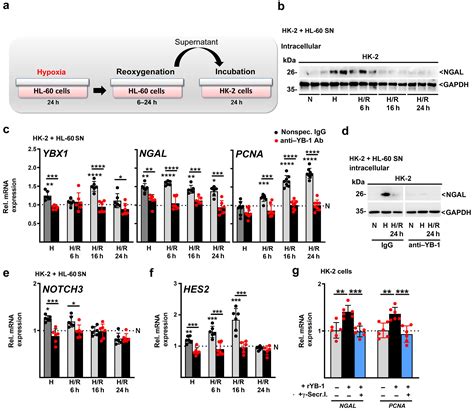 Dna Binding Protein Yb Is A Part Of The Neutrophil Extracellular Trap