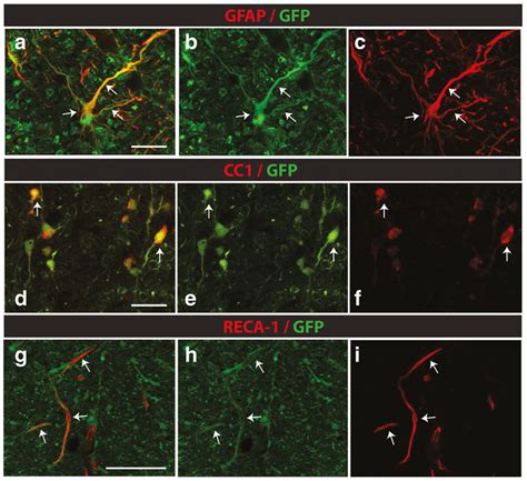 Expression Of Gfp In Glial And Endothelial Cells In Lumbar Spinal Cord