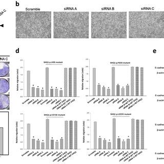 SHQ1 Regulates Neuronal Cell Migration Human SH SY5Y Cells Were