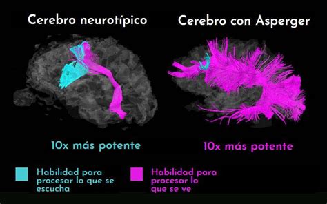 Síndrome De Asperger Síntomas Causas Y Tratamientos