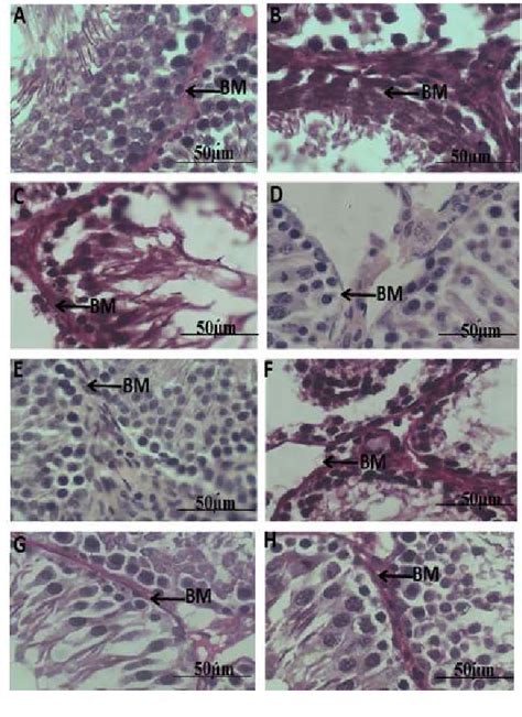 Figure 1 From Histo Morphological And Seminal Evaluation Of Testicular