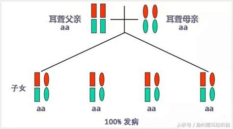 耳聾基因的秘密你要知道的 每日頭條