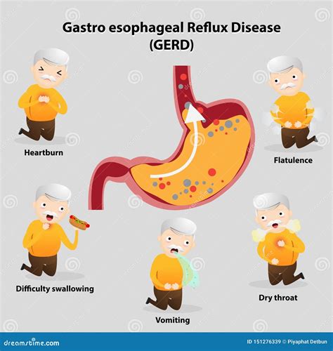 What Causes Belching