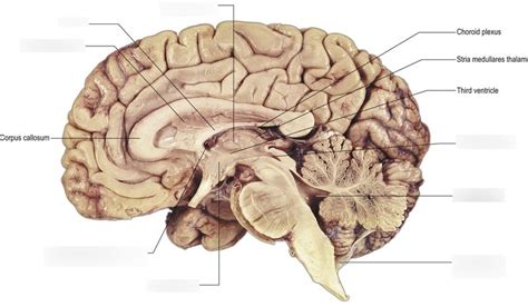 brain medial diagram quizlet