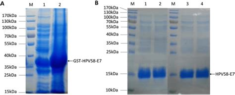 Expression And Purification Of Hpv E Protein A Coomassie Blue