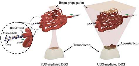 Schematic Of The Focused Ultrasound Mediated Drug Delivery System